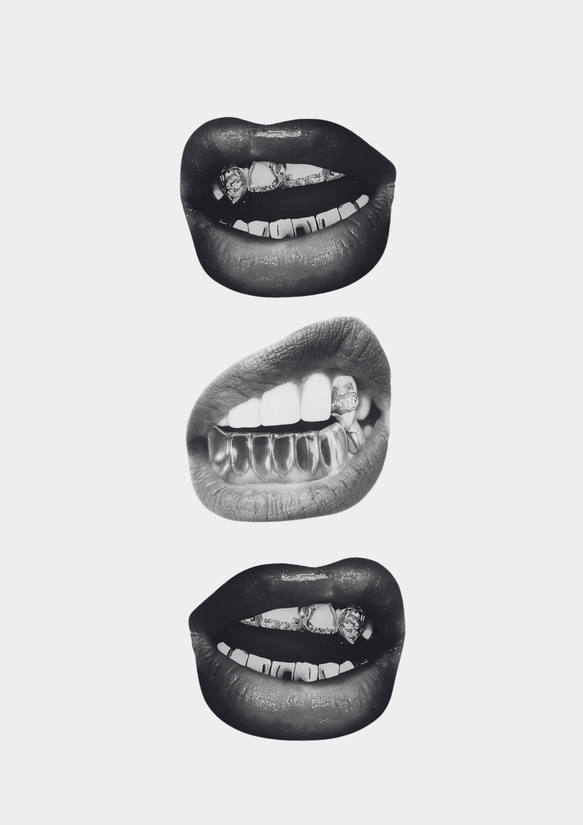 Gold Teeth